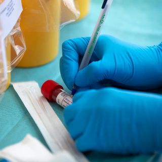 Flurona: Detectan primeros casos de COVID e influenza en México; dos están en Jalisco