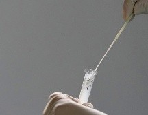 En las últimas 24 horas, fueron notificados cuatro fallecimientos más provocados por el virus. AP/E. Peres