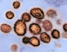 Según las estimaciones, durante la semana del 20 de julio de 2021 se tuvo un punto máximo de hasta 17 mil 810 casos positivos en un solo día. EFE / ARCHIVO