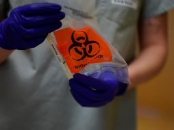 Afirman que el aumento en los precios de las pruebas COVID estaría afectando a un grupo de consumidores, además que proveedores se pueden aprovechar de la escasez. AP / ARCHIVO