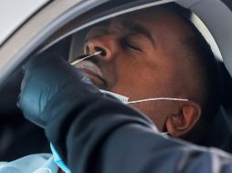 El estudio señalaba que la severidad en el padecimiento de COVID-19 podía afectar el aparato reproductor de los hombres. EFE / E. S. Lesser