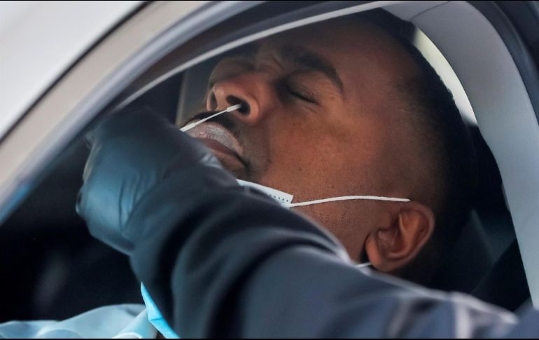 El estudio señalaba que la severidad en el padecimiento de COVID-19 podía afectar el aparato reproductor de los hombres. EFE / E. S. Lesser