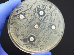 La resistencia a medicamentos antimicrobianos es una amenaza para la salud a nivel mundial. GETTY IMAGES