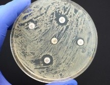 La resistencia a medicamentos antimicrobianos es una amenaza para la salud a nivel mundial. GETTY IMAGES