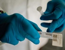 La incubación de la variante de ómicron ocurre en alrededor de tres días. EL INFORMADOR / G. Gallo