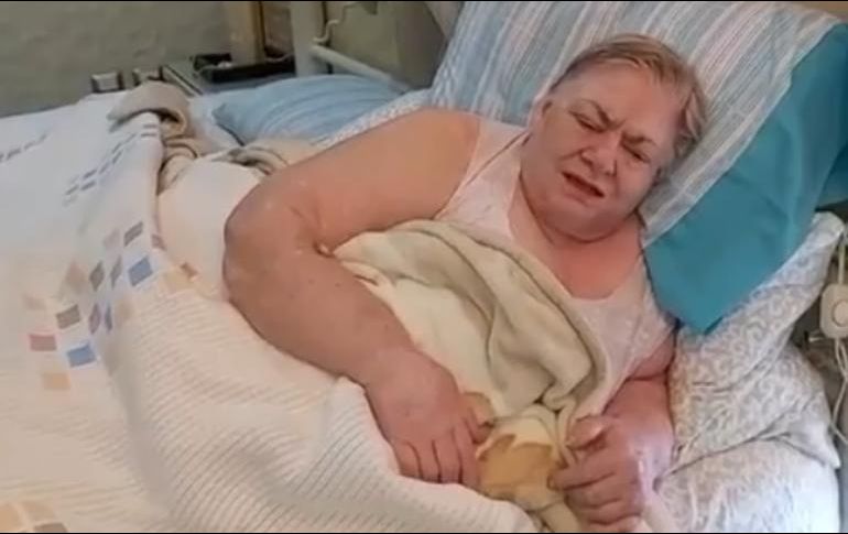 Paquita la del Barrio fue sometida a un tratamiento médico. INSTAGRAM / paquitaoficialb