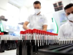 La base de datos de la Secretaría de Salud Jalisco detalla que hay mil seis pacientes hospitalizados en la Entidad. AFP/A. Halada