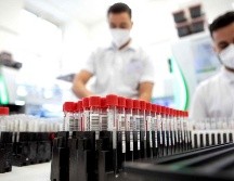 La base de datos de la Secretaría de Salud Jalisco detalla que hay mil seis pacientes hospitalizados en la Entidad. AFP/A. Halada
