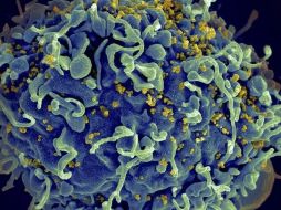 Esta electromicrografía muestra al virus VIH infectando una célula humana. La variante VB generó una mayor carga viral en pacientes que aún no reciben tratamiento.