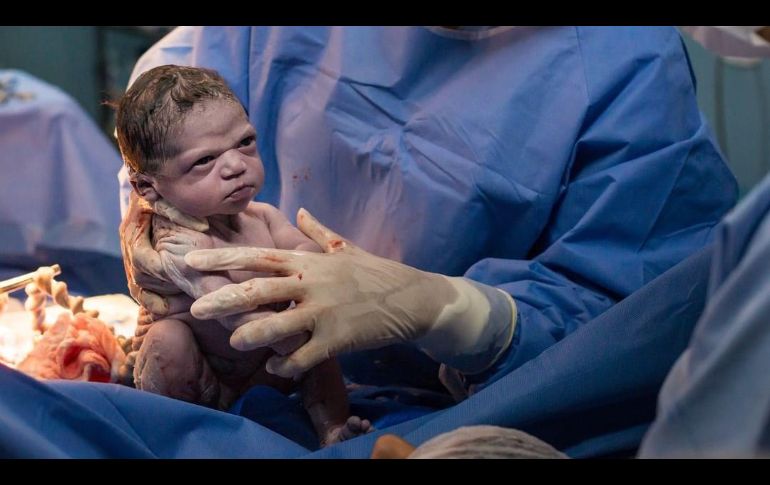 Esta imagen del nacimiento de Isabela Bravinha rápidamente se volvió viral en 2020. INSTAGRAM: @rodrigokunstmann