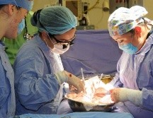 Alistan aumento en trasplantes con aval de cuatro clínicas