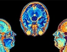 Los cambios se registraron en las zonas vinculadas al olfato y la memoria. UK BIOBANK