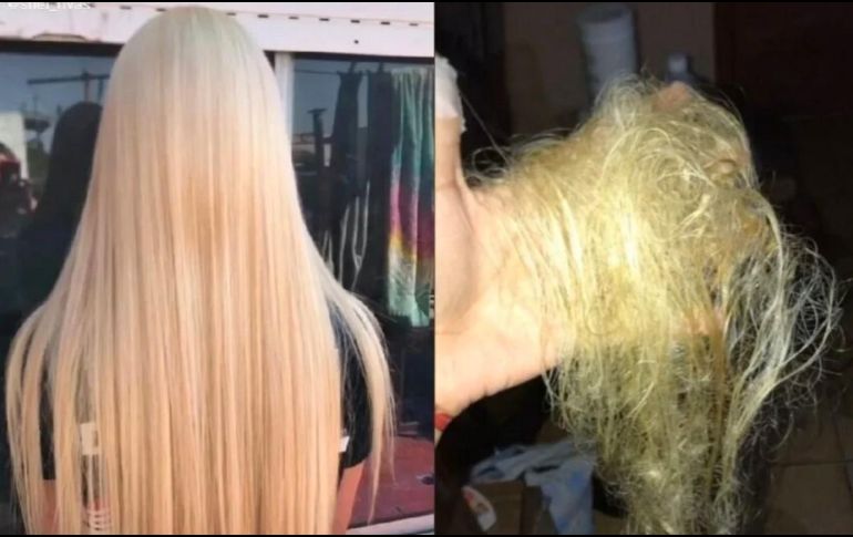 Sheila tuvo que cortar casi todo su cabello, quedándose calva para su cumpleaños número 15. ESPECIAL