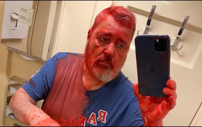 Las imágenes de la agresión con pintura al periodista fueron publicadas por el medio. ESPECIAL