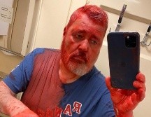 Las imágenes de la agresión con pintura al periodista fueron publicadas por el medio. ESPECIAL