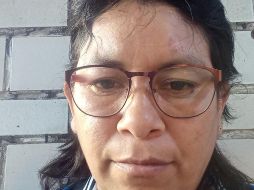 Marisol García Alcántara tiene, encima de su ceja izquierda, la cicatriz que le dejó la bala. CORTESÍA DE MARISOL GARCÍA ALCÁNTARA