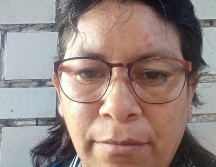 Marisol García Alcántara tiene, encima de su ceja izquierda, la cicatriz que le dejó la bala. CORTESÍA DE MARISOL GARCÍA ALCÁNTARA