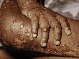 Fuente de la imagen, Science Photo Library