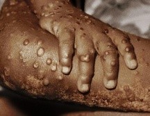 Fuente de la imagen, Science Photo Library