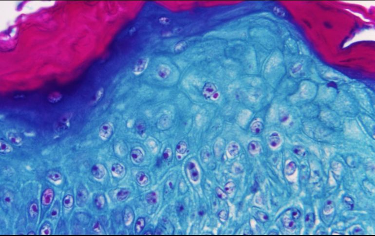 El estudio permitirá tener un panorama más amplio de cómo funciona la enfermedad. EFE/Centro de Control y Prevención de Enfermedades
