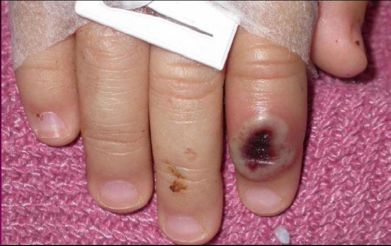 López-Gatell recuerda: 