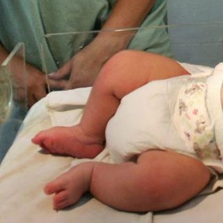 Reportan graves a pacientes sospechosos de hepatitis infantil