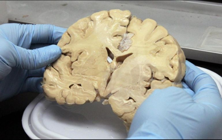 Foto ilustrativa de un cerebro del Banco Nacional de Cerebros. NTX/ARCHIVO