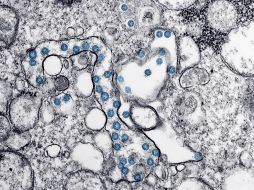 Científicos indican que no hay datos nuevos para evaluar la posibilidad de que el COVID haya salido de un laboratorio. AFP / ARCHIVO