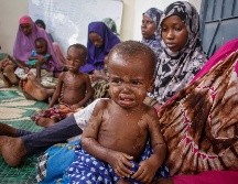 Decenas de niños han fallecido por falta de agua y comida. AP