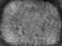 Imagen ilustrativa de un virus de viruela del mono, obtenido de una muestra asociada con el brote de perros de las praderas de 2003. AP/ARCHIVO