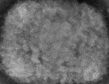 Imagen ilustrativa de un virus de viruela del mono, obtenido de una muestra asociada con el brote de perros de las praderas de 2003. AP/ARCHIVO