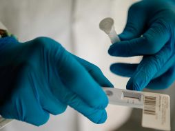 Ambos tienen pendiente resultado del Instituto de Diagnóstico y Referencia Epidemiológicos. EL INFORAMADOR/Archivo