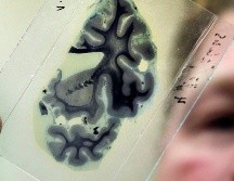 Investigadores estudiaron a 129 pacientes que fumaban a diario y que sufrieron una lesión cerebral. EFE/ARCHIVO