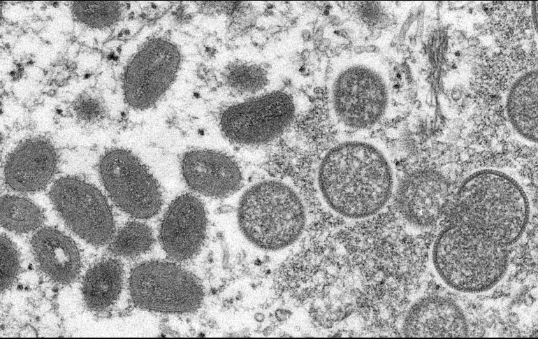 Imagen de microscopio que muestra virus maduros de viruela del mono de forma ovalada, a la izquierda, y virus inmaduros esféricos, a la derecha, obtenidos de una muestra de piel humana. AP/ARCHIVO
