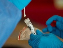 Los síntomas de la viruela del mono son dolor de cabeza, fiebre, agotamiento, ganglios inflamados, dolor de espalda, escalofríos, sarpullido y dolor muscular. AFP / ARCHIVO