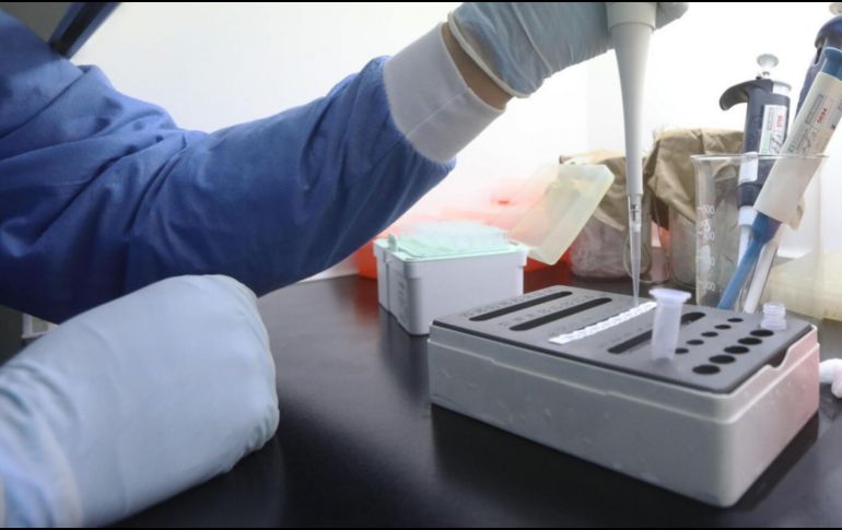 las pruebas PCR que se envían a análisis a laboratorio son las recomendables para detectar la viruela del mono. EL INFORMADOR/ ARCHIVO