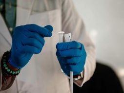 La SSJ reportó tres casos sospechosos más de viruela del mono. EL INFORMADOR/ ARCHIVO