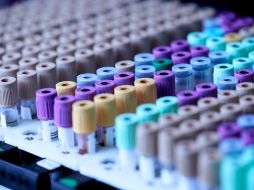 Los casos de virueka del mono aumentan desde mayo más allá de los países donde era endémica. ESPECIAL/Foto de Testalize.me en Unsplash