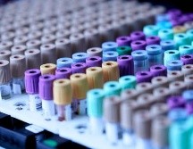 Los casos de virueka del mono aumentan desde mayo más allá de los países donde era endémica. ESPECIAL/Foto de Testalize.me en Unsplash