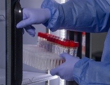 El mundo se ha mantenido alerta ante los casos crecientes de viruela del mono. EFE/ARCHIVO