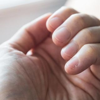 Cómo tus uñas te advierten sobre tu salud y ayudan a detectar enfermedades