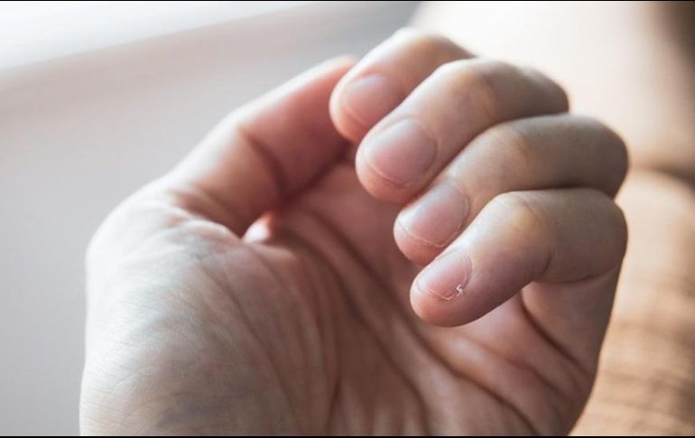 Es importante prestar atención a los cambios de color y la aparición de manchas en las uñas. GETTY IMAGES