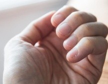 Es importante prestar atención a los cambios de color y la aparición de manchas en las uñas. GETTY IMAGES