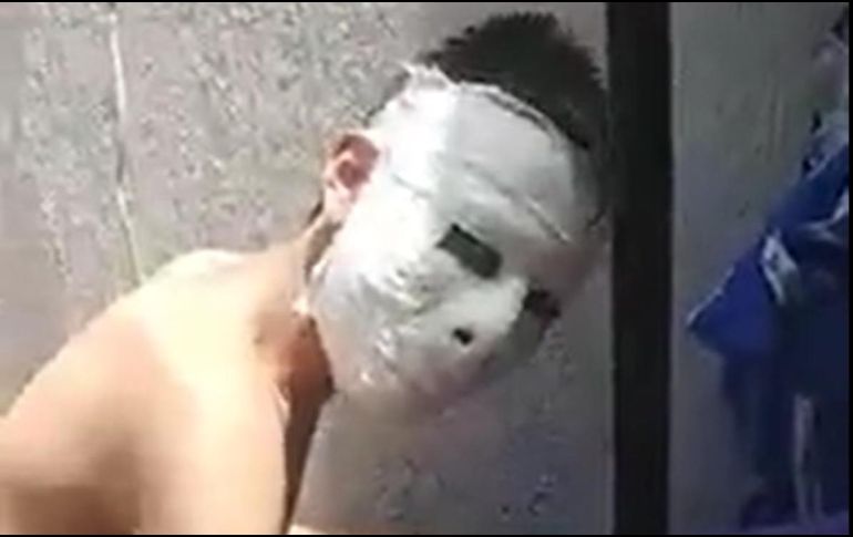 Pese a que el video se viralizó, incluso en Twitter, se desconoce si el joven logró quitarse la máscara de yeso. ESPECIAL