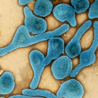 Virus de Marburgo: qué es, cómo se trasmite y cómo prevenir la enfermedad infecciosa detectada otra vez en África