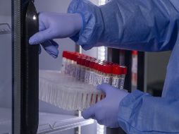 De acuerdo con las autoridades sanitarias a nivel global, se estima que esta enfermedad ha afectado a unas 16 mil personas de 75 países. AP/ARCHIVO