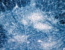 Aunque es una enfermedad incurable que puede causar parálisis muscular e incluso la muerte, la polio se puede prevenir con una vacuna, disponible desde 1955. AP/Emory University