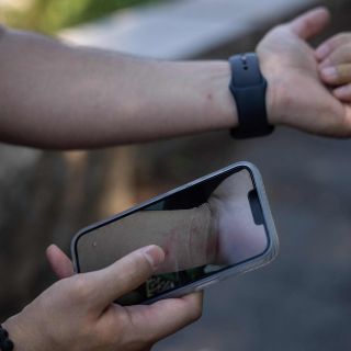 Viruela del mono: El 95% de los casos se transmite vía sexual, señala estudio