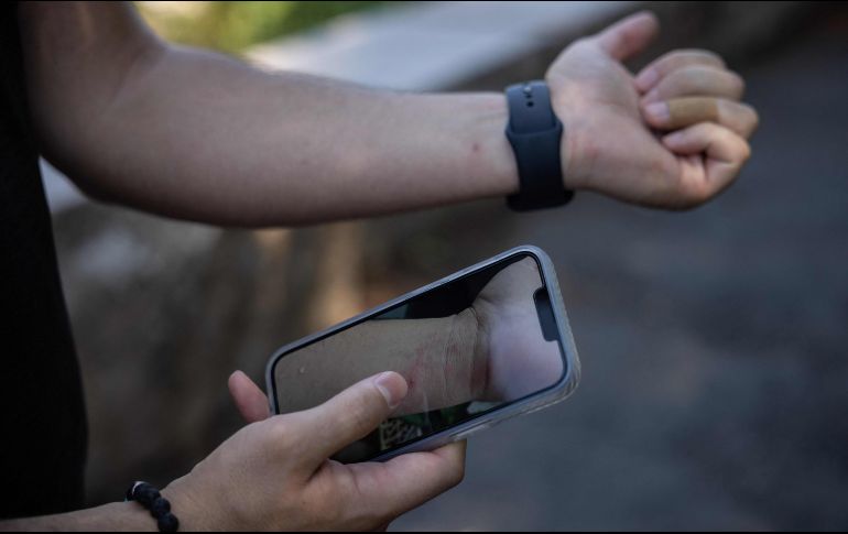 El 98% de las personas infectadas eran hombres gay o bisexuales, el 41% era VIH positivo y su edad promedio era de 38 años. AFP/Y. Iwamura