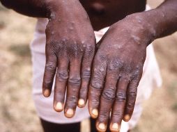 Tedros Adhanom Ghebreyesus, director de la OMS, dijo en una rueda de prensa que el riesgo en el mundo es relativamente moderado, salvo en Europa, donde es alto. AP / ARCHIVO